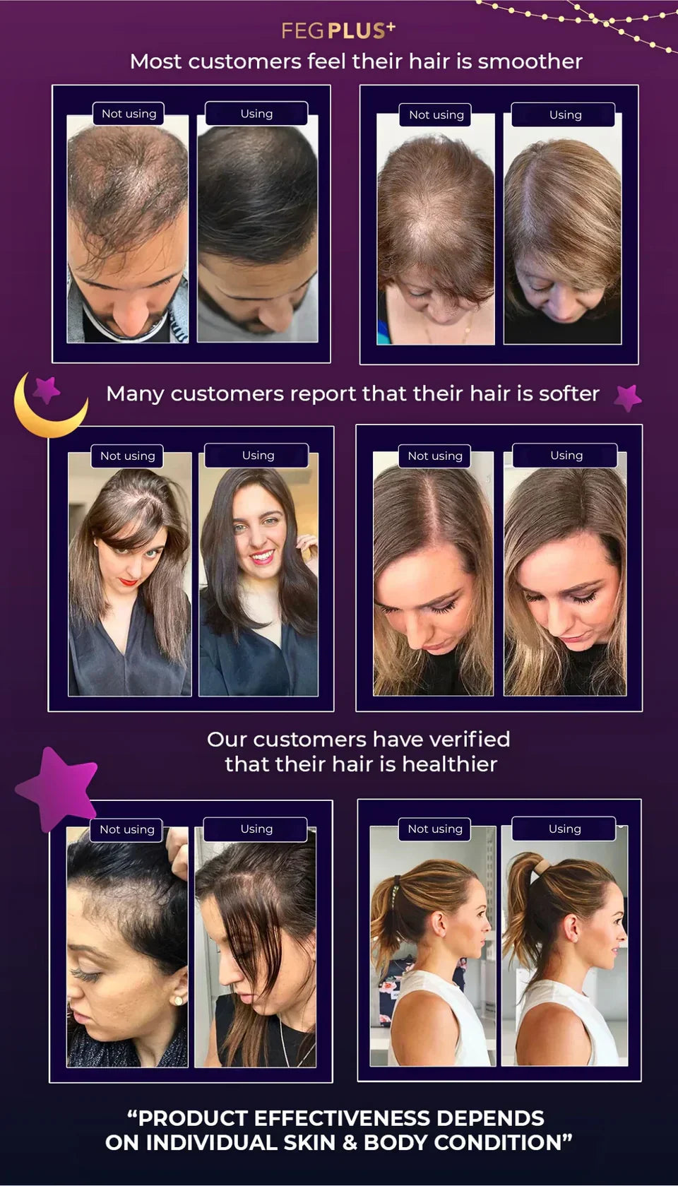 FEG Hair Growth Spray For Both Men & Women - FDA Approved